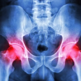 physiotherapy for pelvic floor oakville physiotherapy for pelvic floor oakville