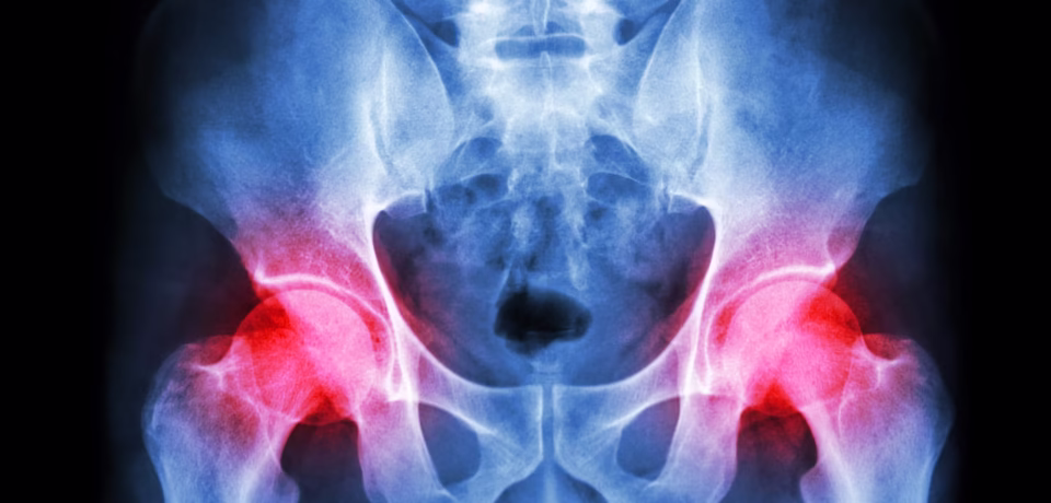 physiotherapy for pelvic floor oakville