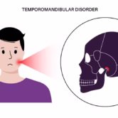 physiotherapy for tmj oakville physiotherapy for tmj oakville
