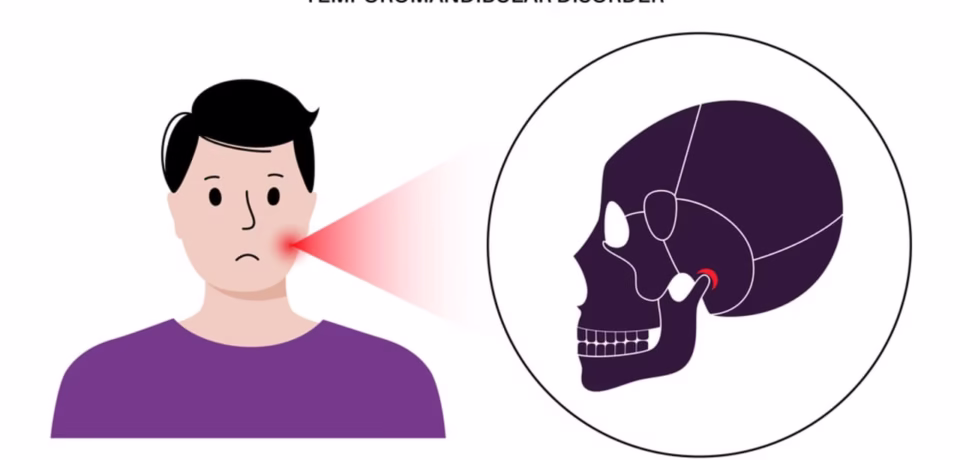 physiotherapy for tmj oakville