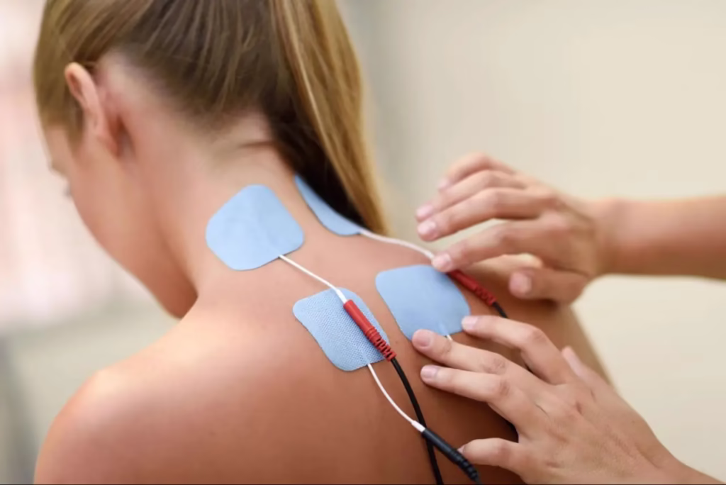 electrical stimulation mississauga